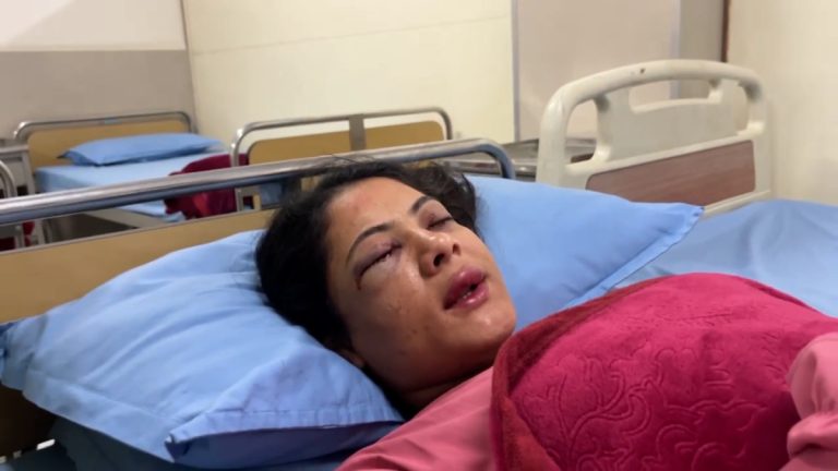 शिक्षक–प्रहरी झडपमा पत्रकार कार्की गम्भीर घाइते, तिलगंगामा उपचार हुँदै RD Creation